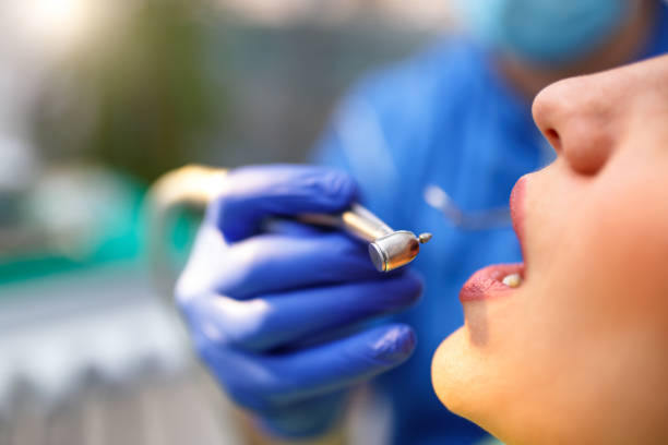 Dental Bonding in Eaton, OH